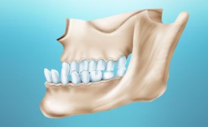 Трансверсальные аномалии зубных рядов