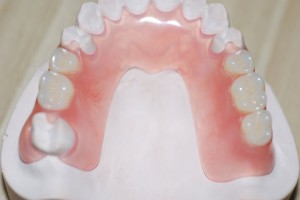 Мягкие и гибкие зубные протезы