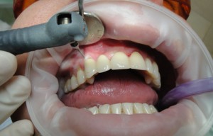 Вектор-терапия в стоматологии