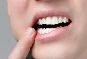 Удаление зубов перед протезированием