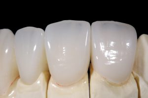 Четыре правила здоровья зубов