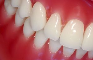 Седация - умный наркоз в стоматологии