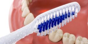 Про уход за зубными протезами