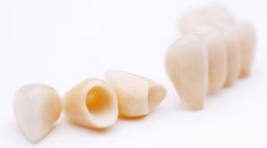 Мифы о зубных коронках в стоматологии