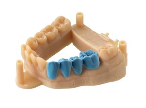 Применение 3D принтеров в стоматологии