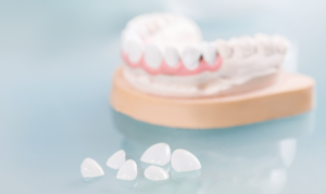 Зубные коронки в стоматологии. Какие лучше?