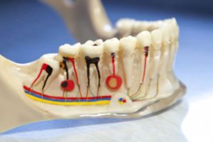 Эндодонтия как целое направление в стоматологии