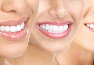 Протезирование зубов: общие сведения