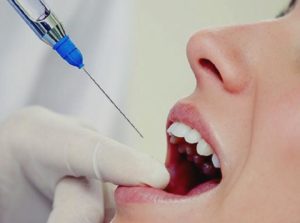 Методы современной анестезии в стоматологии