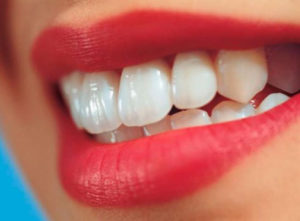 Про этапы эстетической реставрации зубов