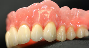 Преимущества мягких протезов на зубы
