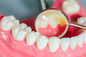Боль после протезирования зубов