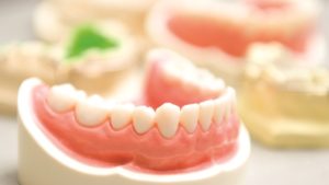Этапы современного протезирования зубов