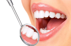 Профилактика зубов в стоматологии