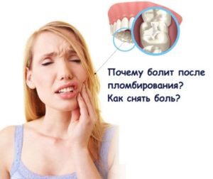 Причины боли после пломбирования зуба