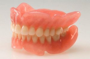 Что такое армирование съемного зубного протеза?